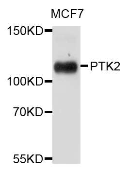 FAK / Focal Adhesion Kinase Antibody - Western blot analysis of extracts of MCF7 cells.