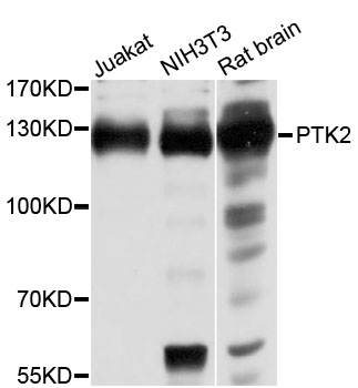 FAK / Focal Adhesion Kinase Antibody - Western blot analysis of extracts of various cell lines, using PTK2 antibody at 1:1000 dilution. The secondary antibody used was an HRP Goat Anti-Rabbit IgG (H+L) at 1:10000 dilution. Lysates were loaded 25ug per lane and 3% nonfat dry milk in TBST was used for blocking. An ECL Kit was used for detection and the exposure time was 30s.