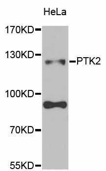 FAK / Focal Adhesion Kinase Antibody - Western blot analysis of extracts of HeLa cells.
