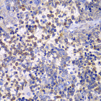 FAK / Focal Adhesion Kinase Antibody - Immunohistochemistry of paraffin-embedded rat spleen tissue.