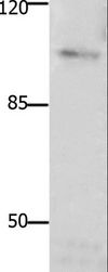 FAK / Focal Adhesion Kinase Antibody - Western blot analysis of Mouse brain tissue, using PTK2 Polyclonal Antibody at dilution of 1:1850.
