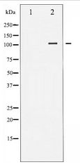 FAK / Focal Adhesion Kinase Antibody - Western blot of FAK expression in NIH-3T3 whole cell lysates,The lane on the left is treated with the antigen-specific peptide.