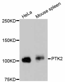 FAK / Focal Adhesion Kinase Antibody - Western blot analysis of extracts of various cell lines, using PTK2 antibody. The secondary antibody used was an HRP Goat Anti-Rabbit IgG (H+L) at 1:10000 dilution. Lysates were loaded 25ug per lane and 3% nonfat dry milk in TBST was used for blocking.