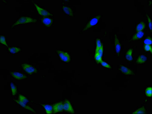 FAK / Focal Adhesion Kinase Antibody - Immunofluorescent analysis of Hela cells using PTK2 Antibody at a dilution of 1:100 and Alexa Fluor 488-congugated AffiniPure Goat Anti-Rabbit IgG(H+L)