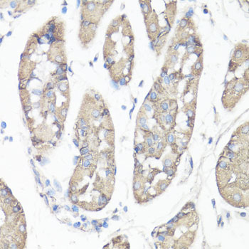 FAK / Focal Adhesion Kinase Antibody - Immunohistochemistry of paraffin-embedded human stomach using PTK2 antibody at dilution of 1:100 (40x lens).