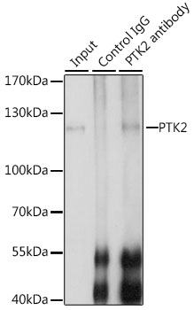 FAK / Focal Adhesion Kinase Antibody - Immunoprecipitation analysis of 200ug extracts of Jurkat cells, using 3 ug PTK2 antibody. Western blot was performed from the immunoprecipitate using PTK2 antibody at a dilition of 1:1000.