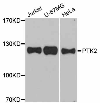FAK / Focal Adhesion Kinase Antibody - Western blot analysis of extracts of various cell lines, using PTK2 antibody at 1:1000 dilution. The secondary antibody used was an HRP Goat Anti-Rabbit IgG (H+L) at 1:10000 dilution. Lysates were loaded 25ug per lane and 3% nonfat dry milk in TBST was used for blocking. An ECL Kit was used for detection and the exposure time was 90s.