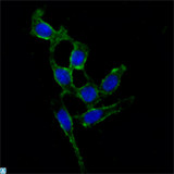 FAK / Focal Adhesion Kinase Antibody - Immunofluorescence (IF) analysis of A549 cells using FAK Monoclonal Antibody (green). Blue: DRAQ5 fluorescent DNA dye.