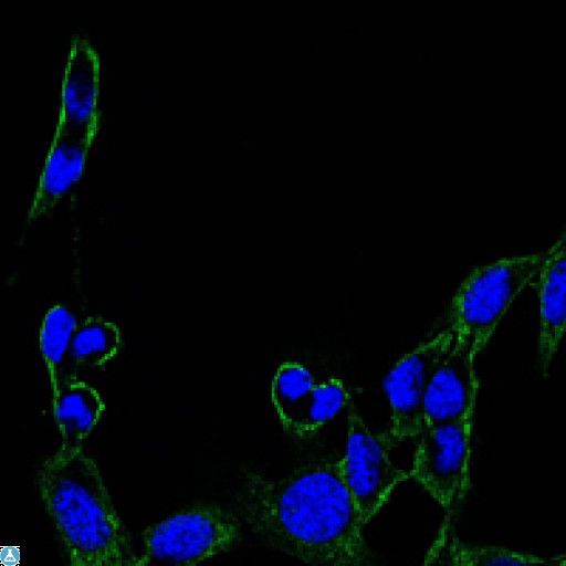 FAK / Focal Adhesion Kinase Antibody - Western Blot (WB) analysis using FAK Monoclonal Antibody against A549 (1) and NIH/3T3 (2) cell lysate.