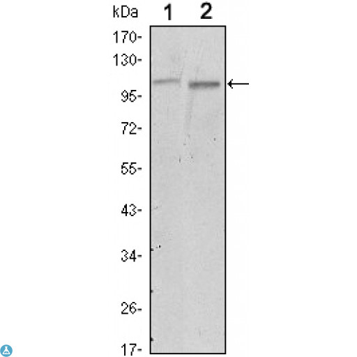 FAK / Focal Adhesion Kinase Antibody - Immunofluorescence (IF) analysis of B16 cells using FAK Monoclonal Antibody (green). Blue: DRAQ5 fluorescent DNA dye.