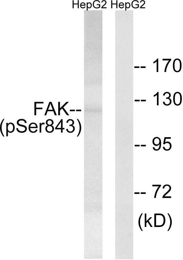 FAK / Focal Adhesion Kinase Antibody - Western blot analysis of lysates from HepG2 cells treated with PMA 125ng/ml 20', using FAK (Phospho-Ser843) Antibody. The lane on the right is blocked with the phospho peptide.