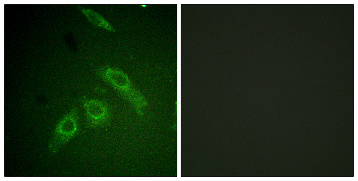 FAK / Focal Adhesion Kinase Antibody - Immunofluorescence analysis of HepG2 cells, using FAK (Phospho-Ser910) Antibody. The picture on the right is blocked with the phospho peptide.
