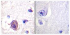 FAK / Focal Adhesion Kinase Antibody - Immunohistochemistry analysis of paraffin-embedded human brain, using FAK (Phospho-Ser910) Antibody. The picture on the right is blocked with the phospho peptide.