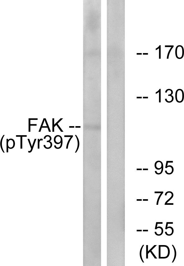 FAK / Focal Adhesion Kinase Antibody - Western blot analysis of lysates from 293 cells treated with EGF 200ng/ml 30', using FAK (Phospho-Tyr397) Antibody. The lane on the right is blocked with the phospho peptide.
