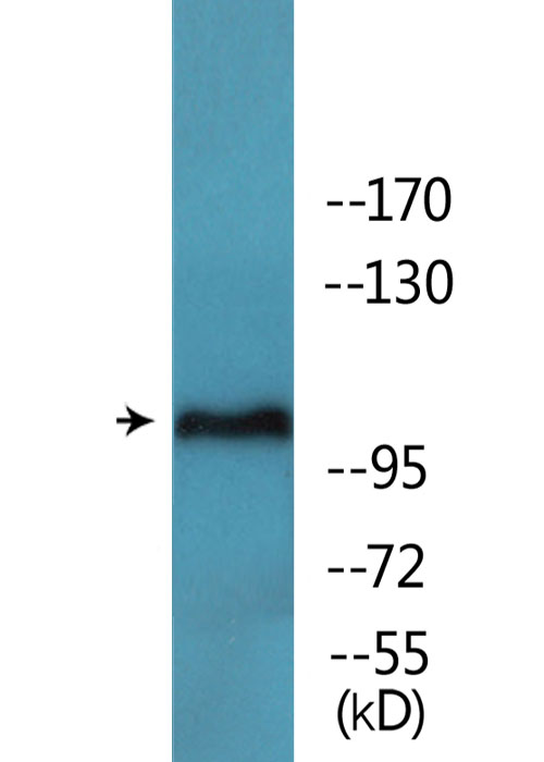 FAK / Focal Adhesion Kinase Antibody - Western blot analysis of lysates from 293 cells treated with EGF 200ng/ml 30', using FAK (Phospho-Tyr397) Antibody.