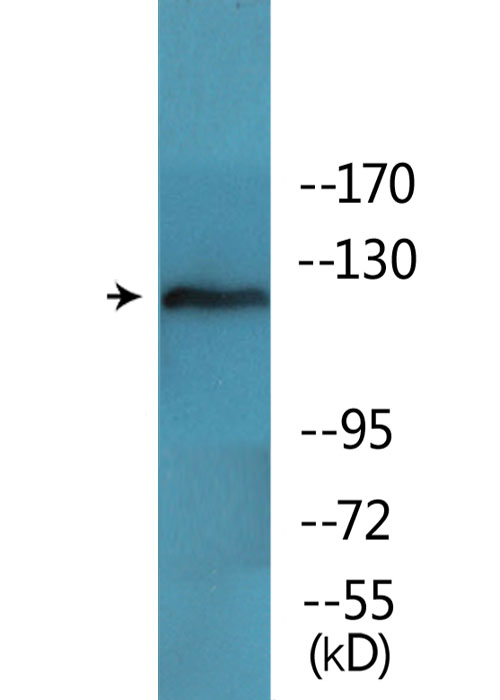 FAK / Focal Adhesion Kinase Antibody - Western blot analysis of lysates from Jurkat cells treated with Ca2+ 40nM 30', using FAK (Phospho-Tyr397) Antibody.