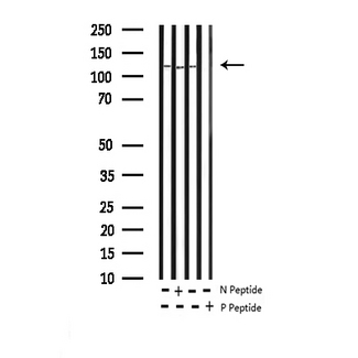 FAK / Focal Adhesion Kinase Antibody - Western blot analysis of Phospho-FAK (Tyr397) expression in various lysates