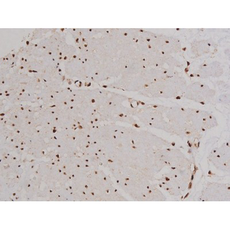 FAK / Focal Adhesion Kinase Antibody - 1:200 staining human esophagus tissue by IHC-P. The tissue was formaldehyde fixed and a heat mediated antigen retrieval step in citrate buffer was performed. The tissue was then blocked and incubated with the antibody for 1.5 hours at 22°C. An HRP conjugated goat anti-rabbit antibody was used as the secondary.