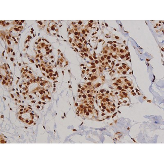 FAK / Focal Adhesion Kinase Antibody - 1:200 staining human heart tissue by IHC-P. The tissue was formaldehyde fixed and a heat mediated antigen retrieval step in citrate buffer was performed. The tissue was then blocked and incubated with the antibody for 1.5 hours at 22°C. An HRP conjugated goat anti-rabbit antibody was used as the secondary.