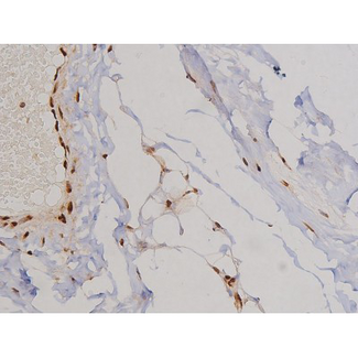 FAK / Focal Adhesion Kinase Antibody - 1:200 staining human heart tissue by IHC-P. The tissue was formaldehyde fixed and a heat mediated antigen retrieval step in citrate buffer was performed. The tissue was then blocked and incubated with the antibody for 1.5 hours at 22°C. An HRP conjugated goat anti-rabbit antibody was used as the secondary.