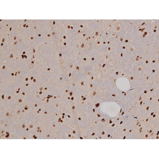 FAK / Focal Adhesion Kinase Antibody - 1:200 staining mouse brain tissue by IHC-P. The tissue was formaldehyde fixed and a heat mediated antigen retrieval step in citrate buffer was performed. The tissue was then blocked and incubated with the antibody for 1.5 hours at 22°C. An HRP conjugated goat anti-rabbit antibody was used as the secondary.