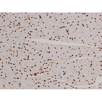 FAK / Focal Adhesion Kinase Antibody - 1:200 staining mouse heart tissue by IHC-P. The tissue was formaldehyde fixed and a heat mediated antigen retrieval step in citrate buffer was performed. The tissue was then blocked and incubated with the antibody for 1.5 hours at 22°C. An HRP conjugated goat anti-rabbit antibody was used as the secondary.