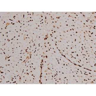FAK / Focal Adhesion Kinase Antibody - 1:200 staining mouse heart tissue by IHC-P. The tissue was formaldehyde fixed and a heat mediated antigen retrieval step in citrate buffer was performed. The tissue was then blocked and incubated with the antibody for 1.5 hours at 22°C. An HRP conjugated goat anti-rabbit antibody was used as the secondary.