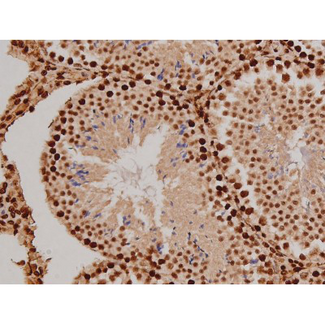 FAK / Focal Adhesion Kinase Antibody - 1:200 staining mouse testis tissue by IHC-P. The tissue was formaldehyde fixed and a heat mediated antigen retrieval step in citrate buffer was performed. The tissue was then blocked and incubated with the antibody for 1.5 hours at 22°C. An HRP conjugated goat anti-rabbit antibody was used as the secondary.