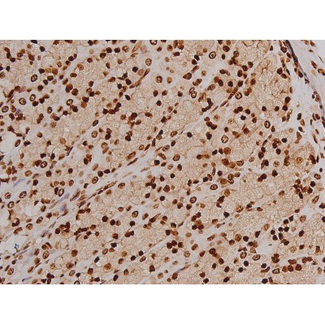FAK / Focal Adhesion Kinase Antibody - 1:200 staining rat ganstric tissue by IHC-P. The tissue was formaldehyde fixed and a heat mediated antigen retrieval step in citrate buffer was performed. The tissue was then blocked and incubated with the antibody for 1.5 hours at 22°C. An HRP conjugated goat anti-rabbit antibody was used as the secondary.