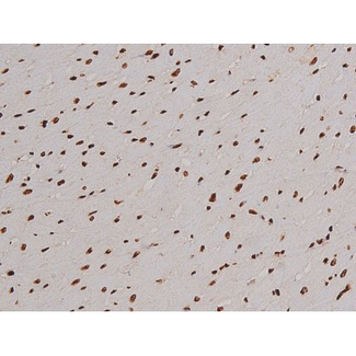 FAK / Focal Adhesion Kinase Antibody - 1:200 staining rat heart tissue by IHC-P. The tissue was formaldehyde fixed and a heat mediated antigen retrieval step in citrate buffer was performed. The tissue was then blocked and incubated with the antibody for 1.5 hours at 22°C. An HRP conjugated goat anti-rabbit antibody was used as the secondary.