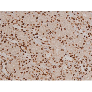FAK / Focal Adhesion Kinase Antibody - 1:200 staining rat kidney tissue by IHC-P. The tissue was formaldehyde fixed and a heat mediated antigen retrieval step in citrate buffer was performed. The tissue was then blocked and incubated with the antibody for 1.5 hours at 22°C. An HRP conjugated goat anti-rabbit antibody was used as the secondary.