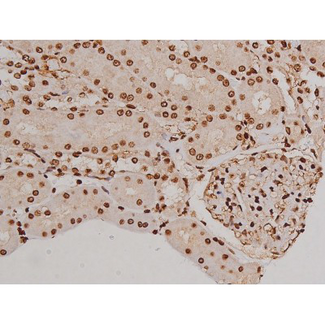 FAK / Focal Adhesion Kinase Antibody - 1:200 staining rat kidney tissue by IHC-P. The tissue was formaldehyde fixed and a heat mediated antigen retrieval step in citrate buffer was performed. The tissue was then blocked and incubated with the antibody for 1.5 hours at 22°C. An HRP conjugated goat anti-rabbit antibody was used as the secondary.