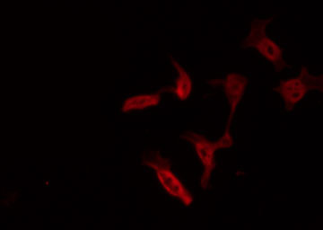 FAK / Focal Adhesion Kinase Antibody - Staining HepG2 cells by IF/ICC. The samples were fixed with PFA and permeabilized in 0.1% Triton X-100, then blocked in 10% serum for 45 min at 25°C. The primary antibody was diluted at 1:200 and incubated with the sample for 1 hour at 37°C. An Alexa Fluor 594 conjugated goat anti-rabbit IgG (H+L) Ab, diluted at 1/600, was used as the secondary antibody.