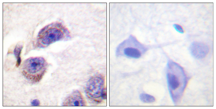 FAK / Focal Adhesion Kinase Antibody - Immunohistochemistry analysis of paraffin-embedded human brain, using FAK (Phospho-Tyr407) Antibody. The picture on the right is blocked with the phospho peptide.