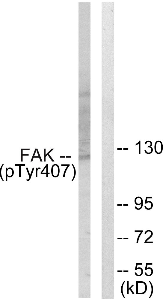 FAK / Focal Adhesion Kinase Antibody - Western blot analysis of lysates from COS7 cells treated with EGF 200ng/ml 30', using FAK (Phospho-Tyr407) Antibody. The lane on the right is blocked with the phospho peptide.
