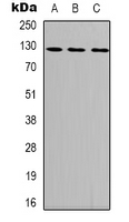 FAK / Focal Adhesion Kinase Antibody - Western blot analysis of Focal Adhesion Kinase (pY407) expression in HEK293T (A); Raw264.7 (B); rat heart (C) whole cell lysates.
