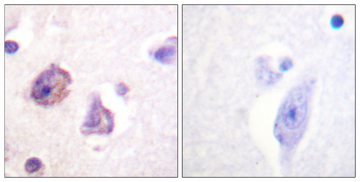 FAK / Focal Adhesion Kinase Antibody - Immunohistochemistry analysis of paraffin-embedded human brain, using FAK (Phospho-Tyr576) Antibody. The picture on the right is blocked with the phospho peptide.