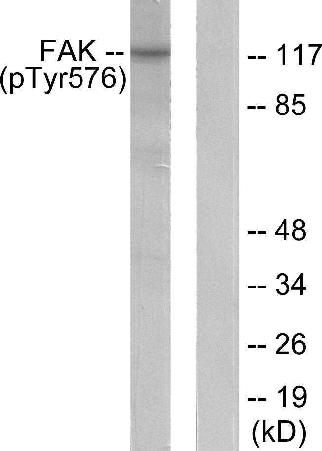 FAK / Focal Adhesion Kinase Antibody - Western blot analysis of lysates from NIH/3T3 cells, using FAK (Phospho-Tyr576) Antibody. The lane on the right is blocked with the phospho peptide.
