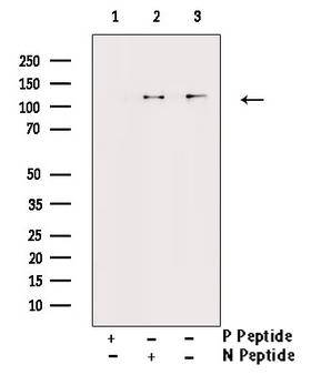 FAK / Focal Adhesion Kinase Antibody - Western blot analysis of Phospho-FAK (Tyr576) antibody expression in NIH-3T3 cells lysates. The lane on the right is treated with the antigen-specific peptide.
