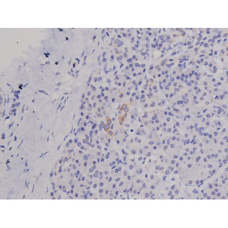 FAK / Focal Adhesion Kinase Antibody - 1:200 staining human pancreas tissue by IHC-P. The tissue was formaldehyde fixed and a heat mediated antigen retrieval step in citrate buffer was performed. The tissue was then blocked and incubated with the antibody for 1.5 hours at 22°C. An HRP conjugated goat anti-rabbit antibody was used as the secondary.