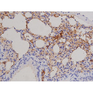 FAK / Focal Adhesion Kinase Antibody - 1:200 staining mouse lung tissue by IHC-P. The tissue was formaldehyde fixed and a heat mediated antigen retrieval step in citrate buffer was performed. The tissue was then blocked and incubated with the antibody for 1.5 hours at 22°C. An HRP conjugated goat anti-rabbit antibody was used as the secondary.
