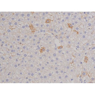 FAK / Focal Adhesion Kinase Antibody - 1:200 staining rat liver tissue by IHC-P. The tissue was formaldehyde fixed and a heat mediated antigen retrieval step in citrate buffer was performed. The tissue was then blocked and incubated with the antibody for 1.5 hours at 22°C. An HRP conjugated goat anti-rabbit antibody was used as the secondary.