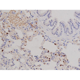 FAK / Focal Adhesion Kinase Antibody - 1:200 staining rat lung tissue by IHC-P. The tissue was formaldehyde fixed and a heat mediated antigen retrieval step in citrate buffer was performed. The tissue was then blocked and incubated with the antibody for 1.5 hours at 22°C. An HRP conjugated goat anti-rabbit antibody was used as the secondary.
