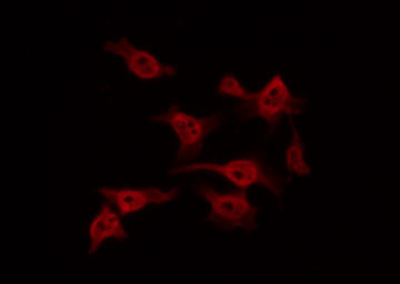FAK / Focal Adhesion Kinase Antibody - Staining NIH-3T3 cells by IF/ICC. The samples were fixed with PFA and permeabilized in 0.1% Triton X-100, then blocked in 10% serum for 45 min at 25°C. The primary antibody was diluted at 1:200 and incubated with the sample for 1 hour at 37°C. An Alexa Fluor 594 conjugated goat anti-rabbit IgG (H+L) Ab, diluted at 1/600, was used as the secondary antibody.