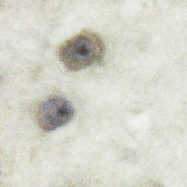 FAK / Focal Adhesion Kinase Antibody - 1/100 staining human brain tissue by IHC-P. The sample was formaldehyde fixed and a heat mediated antigen retrieval step in citrate buffer was performed. The sample was then blocked and incubated with the antibody for 1.5 hours at 22°C. An HRP conjugated goat anti-rabbit antibody was used as the secondary antibody.