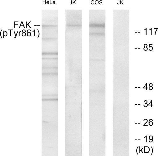 FAK / Focal Adhesion Kinase Antibody - Western blot analysis of lysates from HeLa cells, Jurkat cells and COS cells, using FAK (Phospho-Tyr861) Antibody. The lane on the right is blocked with the phospho peptide.