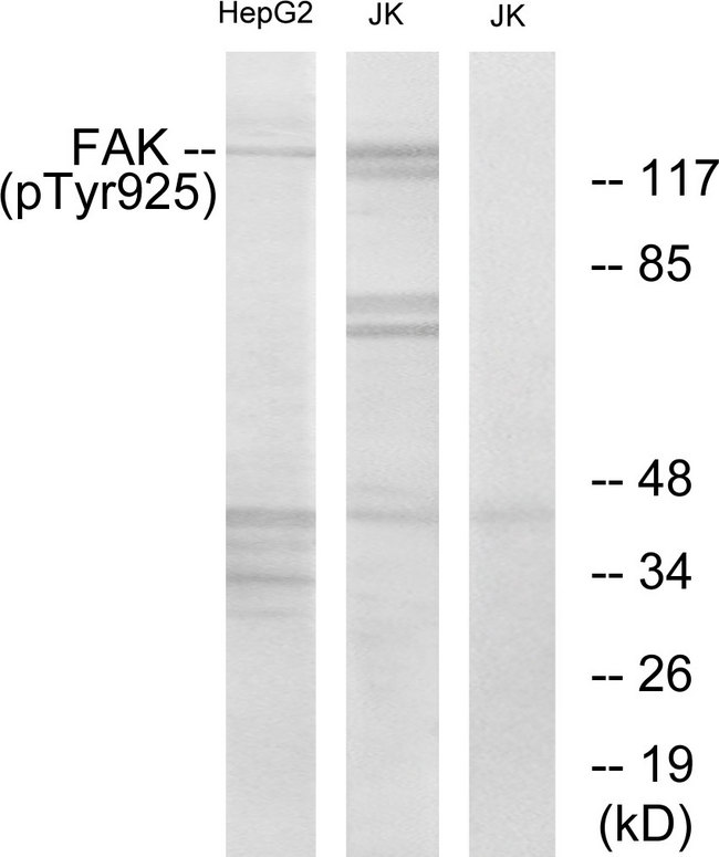 FAK / Focal Adhesion Kinase Antibody - Western blot analysis of lysates from Jurkat and HepG2 cells, using FAK (Phospho-Tyr925) Antibody. The lane on the right is blocked with the phospho peptide.