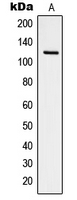 FAK / Focal Adhesion Kinase Antibody - Western blot analysis of Focal Adhesion Kinase (pY925) expression in NIH3T3 pervanadate-treated (A) whole cell lysates.