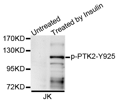 FAK / Focal Adhesion Kinase Antibody - Western blot analysis of extracts of Jurkat cells.