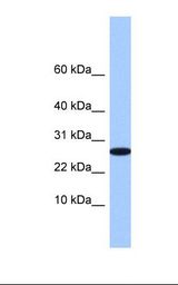 FAM101A Antibody - 721_B cell lysate. Antibody concentration: 1.0 ug/ml. Gel concentration: 10-20%.  This image was taken for the unconjugated form of this product. Other forms have not been tested.